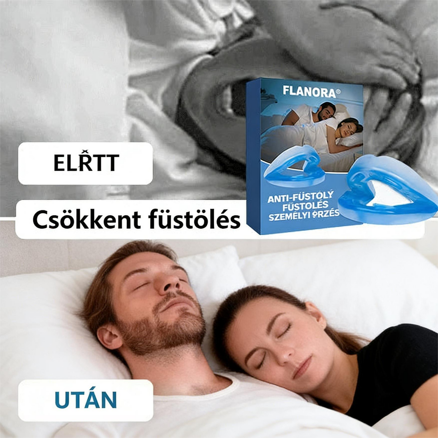 😴 Flanora horkolásgátló eszköz: Csökkentse a horkolást már az első éjszakától! ✨